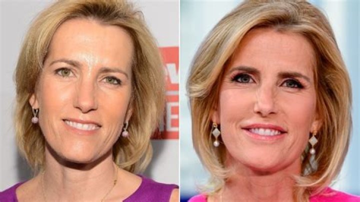 Laura Ingraham's Plastic Surgery Journey Revealed